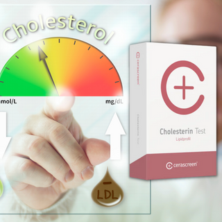 Gesundheits-Check: Selbsttests für Vitalstoffe und Allergien